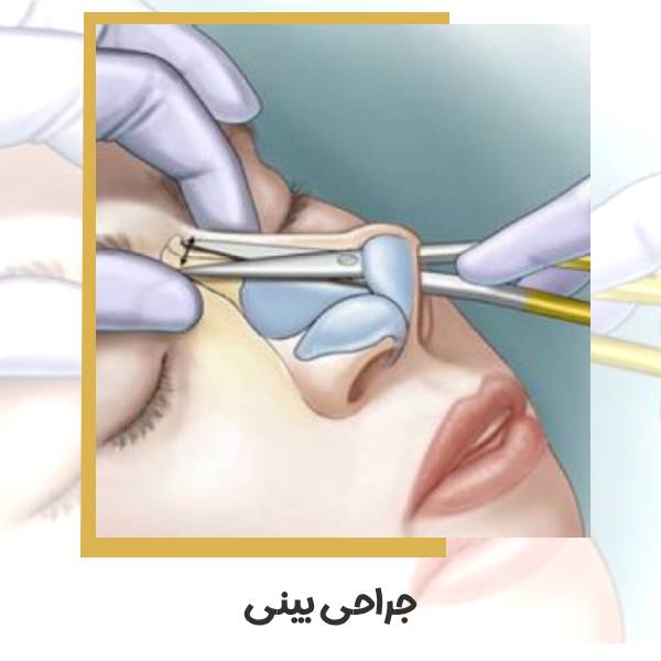 جراحی بینی